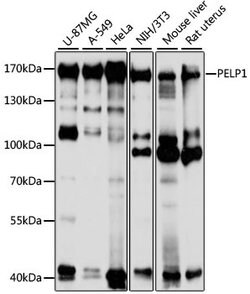 Invitrogen MNAR Polyclonal Antibody 100 &mu;L; Unconjugated:Antibodies,