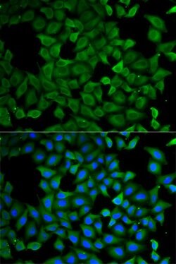 Invitrogen ATL1 Polyclonal Antibody 100 &mu;L; Unconjugated:Antibodies,