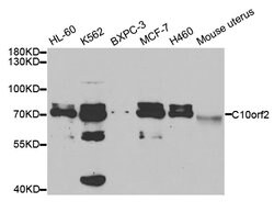 Invitrogen PEO1 Polyclonal Antibody 100 &mu;L | Buy Online | Invitrogen&trade; | Fisher Scientific