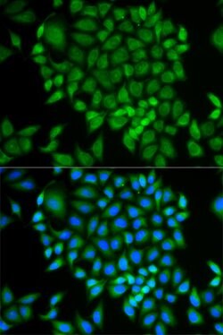 Invitrogen GLRX Polyclonal Antibody 100 &mu;L; Unconjugated:Antibodies,