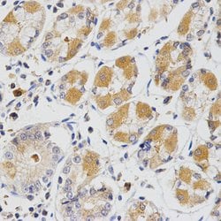 Invitrogen GLRX Polyclonal Antibody 100 &mu;L; Unconjugated:Antibodies,