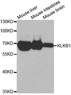Invitrogen Plasma Kallikrein Polyclonal Antibody 100 &mu;L; Unconjugated:Antibodies,