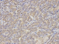 Invitrogen S100A12 Polyclonal Antibody 100 &mu;L; Unconjugated:Antibodies,