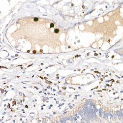 Invitrogen S100A12 Polyclonal Antibody 100 &mu;L; Unconjugated:Antibodies,