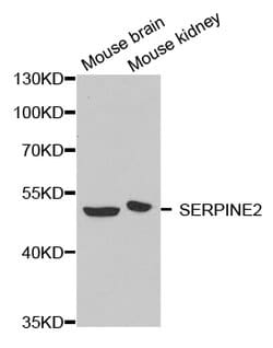 Invitrogen SERPINE2 Polyclonal Antibody 100 &mu;L | Buy Online | Invitrogen&trade; | Fisher Scientific