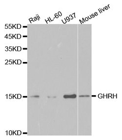 Invitrogen GHRH Polyclonal Antibody 100 &mu;L; Unconjugated:Antibodies,