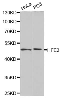 Invitrogen HFE2 Polyclonal Antibody 100 &mu;L; Unconjugated:Antibodies,