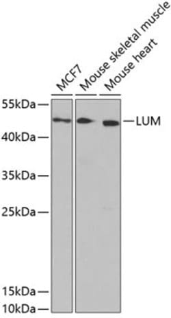 Invitrogen LUM Polyclonal Antibody 100 &mu;L; Unconjugated:Antibodies,