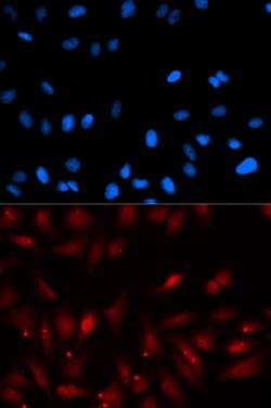 Invitrogen EBP1 Polyclonal Antibody 100 &mu;L; Unconjugated:Antibodies,