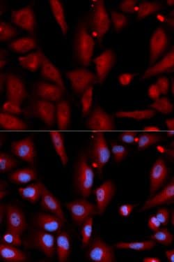 WIF1 Polyclonal Antibody, Invitrogen 100 &mu;L; Unconjugated:Antibodies,