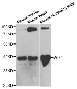 WIF1 Polyclonal Antibody, Invitrogen 100 &mu;L; Unconjugated:Antibodies,