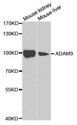 Invitrogen ADAM9 Polyclonal Antibody 100 &mu;L; Unconjugated:Antibodies,