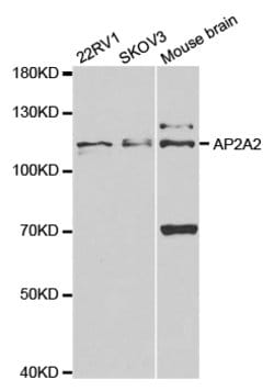 Invitrogen AP2A2 Polyclonal Antibody 100 &mu;L; Unconjugated:Antibodies,