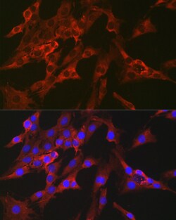 Invitrogen FBP1 Polyclonal Antibody 100 &mu;L; Unconjugated:Antibodies,