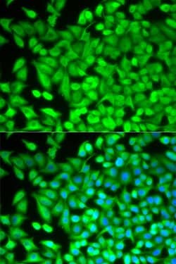 Invitrogen FBP1 Polyclonal Antibody 100 &mu;L; Unconjugated:Antibodies,