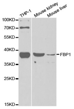 Invitrogen FBP1 Polyclonal Antibody 100 &mu;L; Unconjugated:Antibodies,