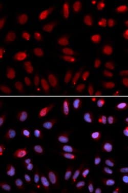 Invitrogen HUS1 Polyclonal Antibody 100 &mu;L; Unconjugated:Antibodies,
