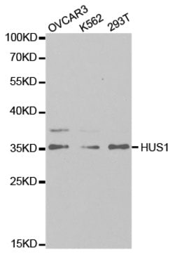 Invitrogen HUS1 Polyclonal Antibody 100 &mu;L; Unconjugated:Antibodies,
