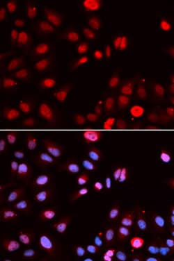 Invitrogen MPG Polyclonal Antibody 100 &mu;L; Unconjugated:Antibodies,
