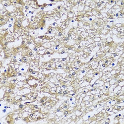Invitrogen NQO2 Polyclonal Antibody 100 &mu;L; Unconjugated:Antibodies,
