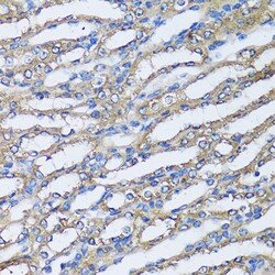 Invitrogen NQO2 Polyclonal Antibody 100 &mu;L; Unconjugated:Antibodies,