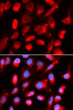 Invitrogen UROD Polyclonal Antibody 100 &mu;L; Unconjugated:Antibodies,