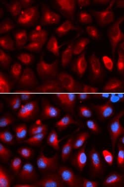 Invitrogen KLC1 Polyclonal Antibody 100 &mu;L; Unconjugated:Antibodies,