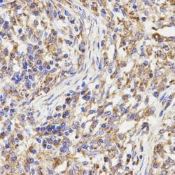 Invitrogen KLC1 Polyclonal Antibody 100 &mu;L; Unconjugated:Antibodies,