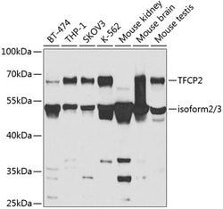 Invitrogen TFCP2 Polyclonal Antibody 100 &mu;L; Unconjugated:Antibodies,
