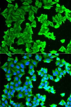 Invitrogen RPLP0 Polyclonal Antibody 100 &mu;L; Unconjugated:Antibodies,