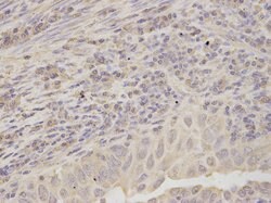 Invitrogen RPLP0 Polyclonal Antibody 100 &mu;L; Unconjugated:Antibodies,