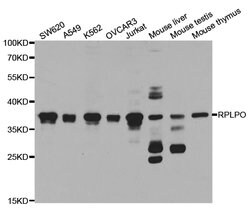 Invitrogen RPLP0 Polyclonal Antibody 100 &mu;L; Unconjugated:Antibodies,