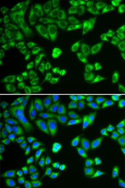 Invitrogen SH2B1 Polyclonal Antibody 100 &mu;L; Unconjugated:Antibodies,