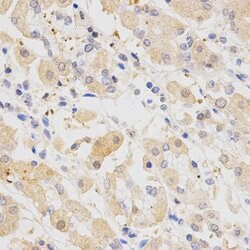 Invitrogen SH2B1 Polyclonal Antibody 100 &mu;L; Unconjugated:Antibodies,