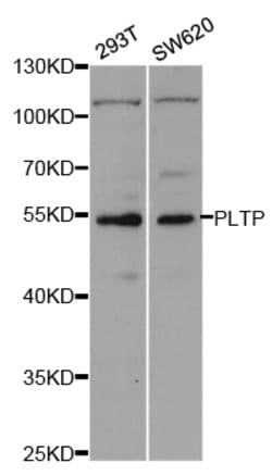 Invitrogen PLTP Polyclonal Antibody 100 &mu;L; Unconjugated:Antibodies,
