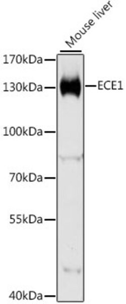 Invitrogen ECE1 Polyclonal Antibody 100 &mu;L; Unconjugated:Antibodies,