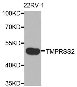 Invitrogen TMPRSS2 Polyclonal Antibody 100 &mu;L | Buy Online | Invitrogen&trade; | Fisher Scientific