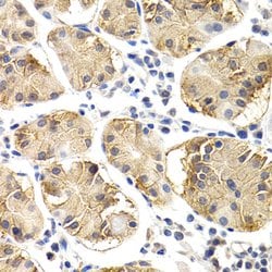 Invitrogen Chitotriosidase Polyclonal Antibody 100 &mu;L | Buy Online | Invitrogen&trade; | Fisher Scientific