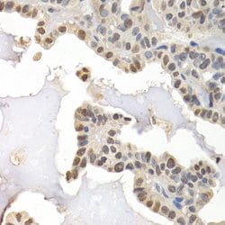 Invitrogen GTF2F1 Polyclonal Antibody 100 &mu;L; Unconjugated:Antibodies,