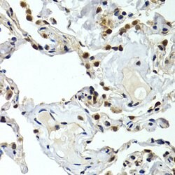 Invitrogen GTF2F1 Polyclonal Antibody 100 &mu;L; Unconjugated:Antibodies,