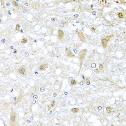 Invitrogen ATP2C1 Polyclonal Antibody 100 &mu;L; Unconjugated:Antibodies,