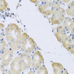 Invitrogen ATP2C1 Polyclonal Antibody 100 &mu;L; Unconjugated:Antibodies,