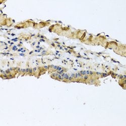 Invitrogen ATP2C1 Polyclonal Antibody 100 &mu;L; Unconjugated:Antibodies,