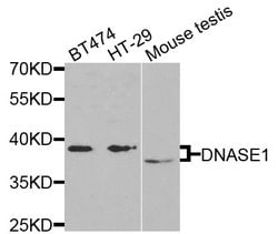 Invitrogen DNase I Polyclonal Antibody 100 &mu;L; Unconjugated:Antibodies,