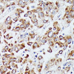 Invitrogen DUT Polyclonal Antibody 100 &mu;L; Unconjugated:Antibodies,