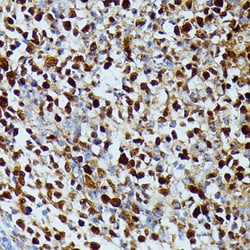 Invitrogen DUT Polyclonal Antibody 100 &mu;L; Unconjugated:Antibodies,