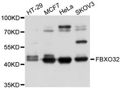 Invitrogen FBXO32 Polyclonal Antibody 100 &mu;L; Unconjugated:Antikroppar