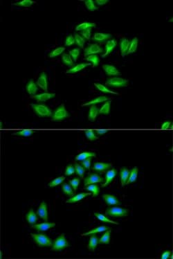 Invitrogen CPT1A Polyclonal Antibody 100 &mu;L; Unconjugated:Antibodies,