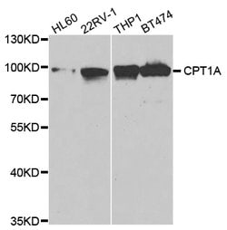 Invitrogen CPT1A Polyclonal Antibody 100 &mu;L; Unconjugated:Antibodies,