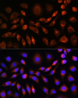 Invitrogen Apolipoprotein M Polyclonal Antibody 100 &mu;L; Unconjugated:Antibodies,